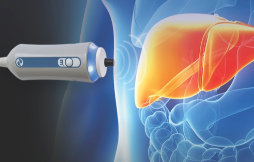 Эластометрия печени